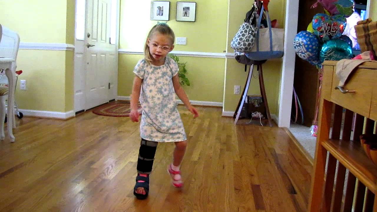 walking post op cast 2 - YouTube