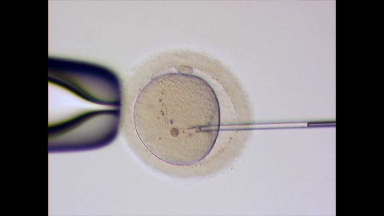 Die ICSI - Methode der Befruchtung - Kinderwunschzentrum an der Wien
