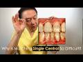 Perfectly Matching Single, Central Restorations to Adjacent Teeth