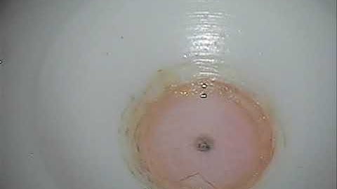 DSEK manual graft preparation