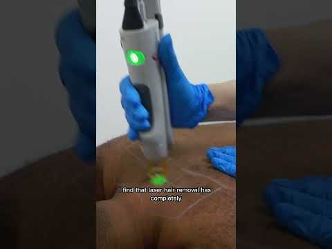 Men, See What You've Been Missing With Laser Hair Removal!