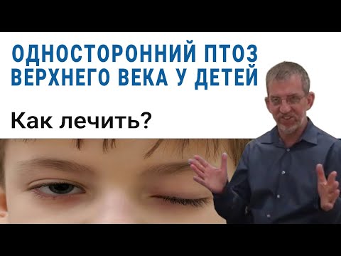 Односторонний птоз верхнего века у детей. Как и когда лечить?