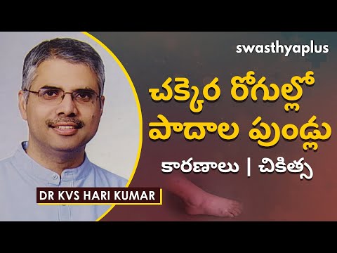 చక్కెర రోగుల్లో పాదాల పుండ్లు – కారణాలు, చికిత్స | Diabetic Foot Ulcer in Telugu | Dr KVS Hari Kumar
