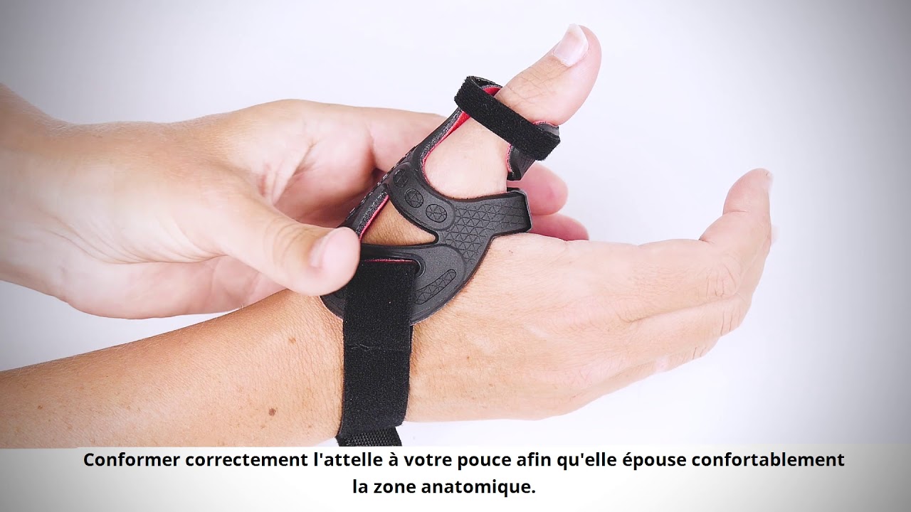 DonJoy® RhizoForm™ - Mise en place