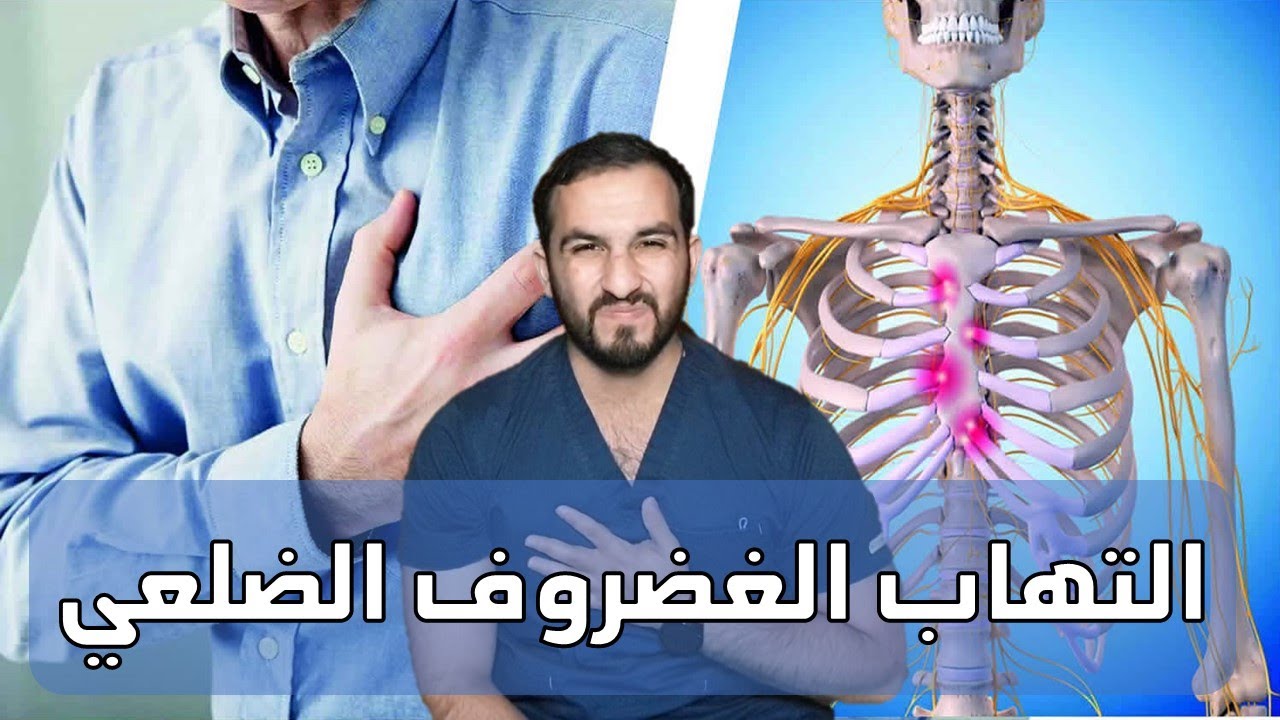 آلام الصدر - التهاب الغضروف الضلعي 😫😥