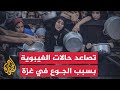 مع تصاعد التحذيرات من موت جماعي بسبب الجوع مراسل الجزيرة يرصد الأوضاع الميدانية والإنسانية في غزة مع تصاعد التحذيرات من موت جماعي بسبب الجوع مراسل الجزيرة يرصد الأوضاع الميدانية والإنسانية في غزة