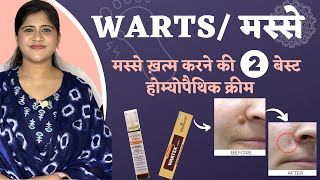 Warts/ मस्से : ख़त्म करने की 2 बेस्ट होम्योपैथिक क्रीम | Warts Homeopathic Treatment |Dr. Arwa Bohra screenshot 1