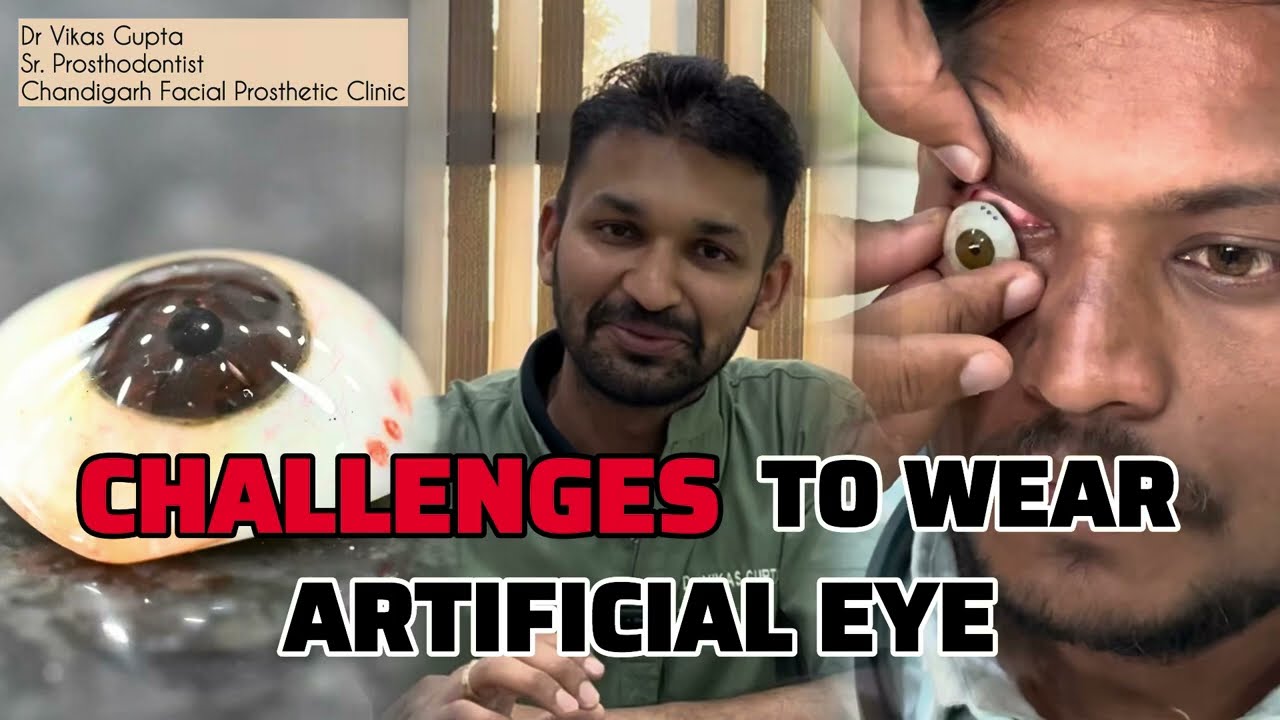 HOW TO WEAR ARTIFICIAL EYE - dummy/ नकली आँख कैसे पहने- full explanation with patient