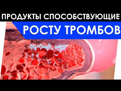 5 продуктов, которые способствуют росту ТРОМБОВ / Продукты запрещенные при ТРОМБОЗЕ