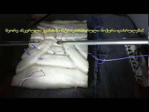 ქირურგიული კვანძები და მარყუჟები - ვიდეო #23 ანკერული კვანძი