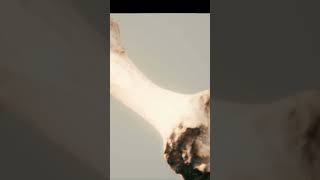 Tulang Paha Mia Ternyata Sekuat Itu