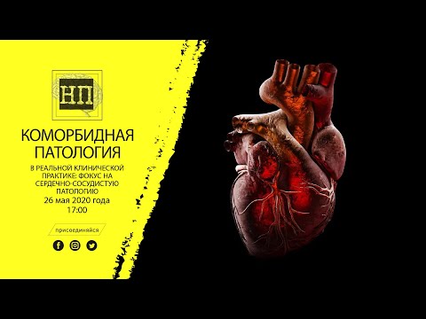 Актуальные вопросы коморбидной патологии. Вебинар 26.05.2020