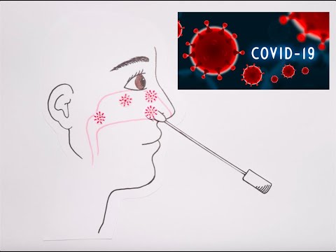 Video: Ministerstvo Zdravotníctva Vypočítalo, Koľko Testov Na COVID-19 Môže Byť Chybných