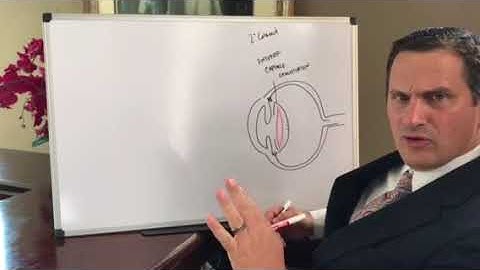 Can a cataract come back after cataract surgery? Secondary cataracts explained