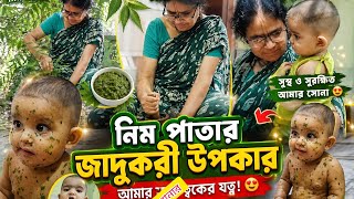 Skin care। বেবি স্কিনের যত্ন। নিমপাতার ক্ষতি ও উপকার।  #viralvideo #nimpata @Shivangistyle 