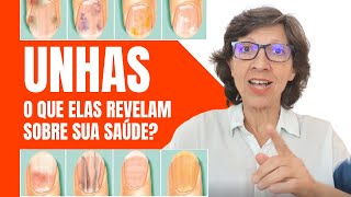 UNHAS - O que elas REVELAM sobre sua SAÚDE?