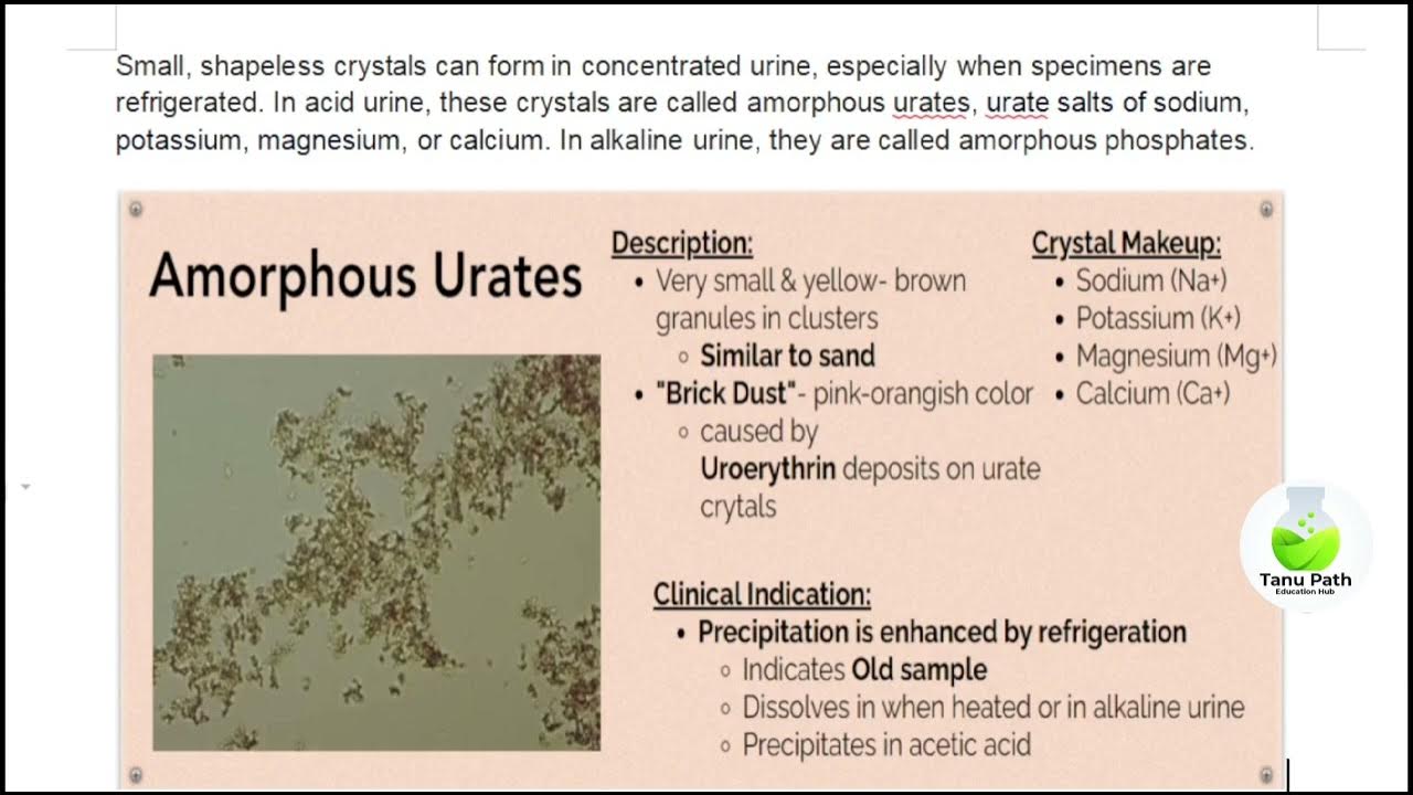 Amorphous Material In Urine Test