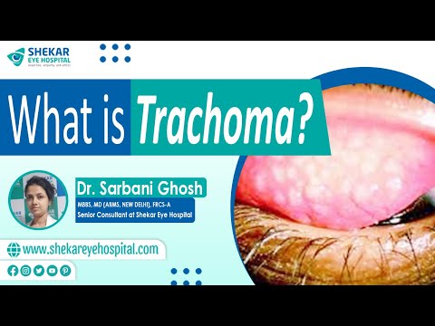 Symptoms &amp; Causes of Trachoma | Treatments and Stages of Trachoma | Shekar Eye Hospital, Bangalore