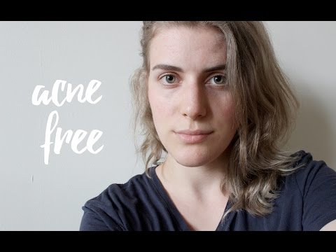 HOW I AM HEALING MY CYSTIC ACNE NATURALLY