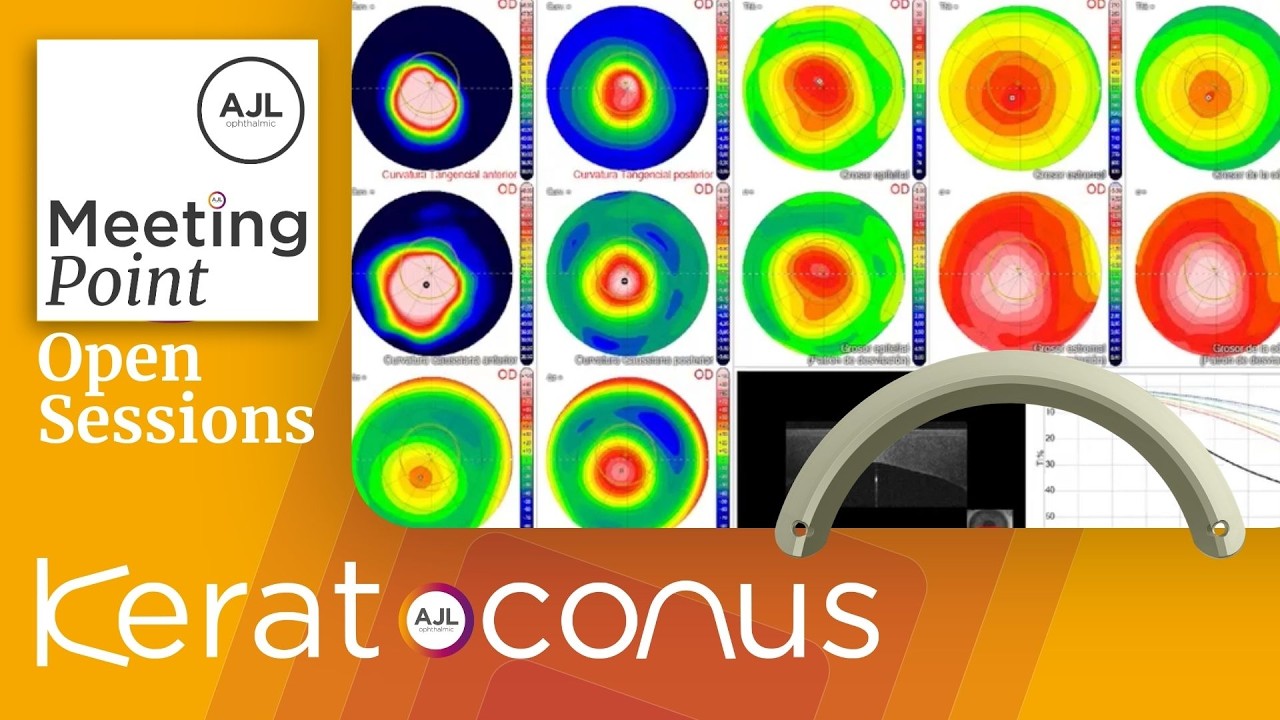 ES | MP Keratoconus Open Sessions. Clasificación de Fenotipos II