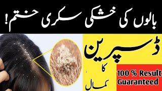 Remedy to treat Dandruff | بالوں کی خشکی سکری کا خاتمہ | homeremedy