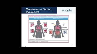 June 2020 Journal Club Webinar