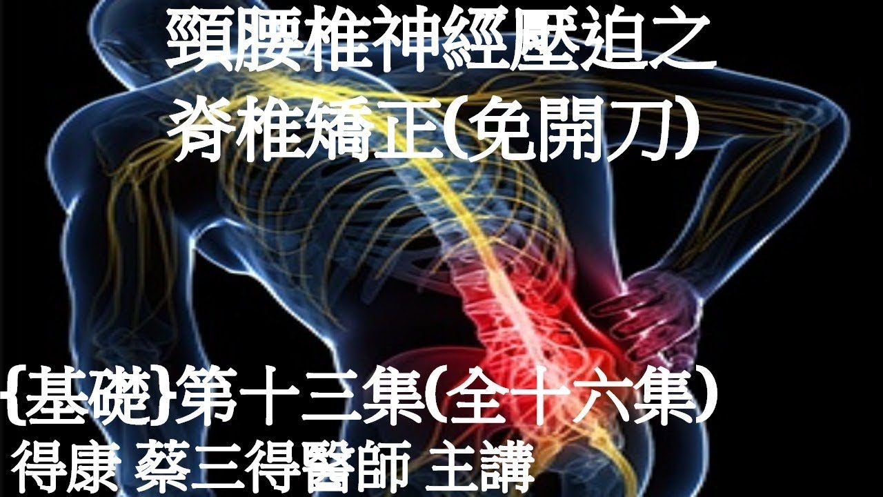 第十三集 腰椎側彎椎間盤突出神經壓迫需開刀 三個案例 Youtube