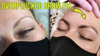 My Secret Weapon for Fixing Overplucked Thin Brows (One Time Treatment)