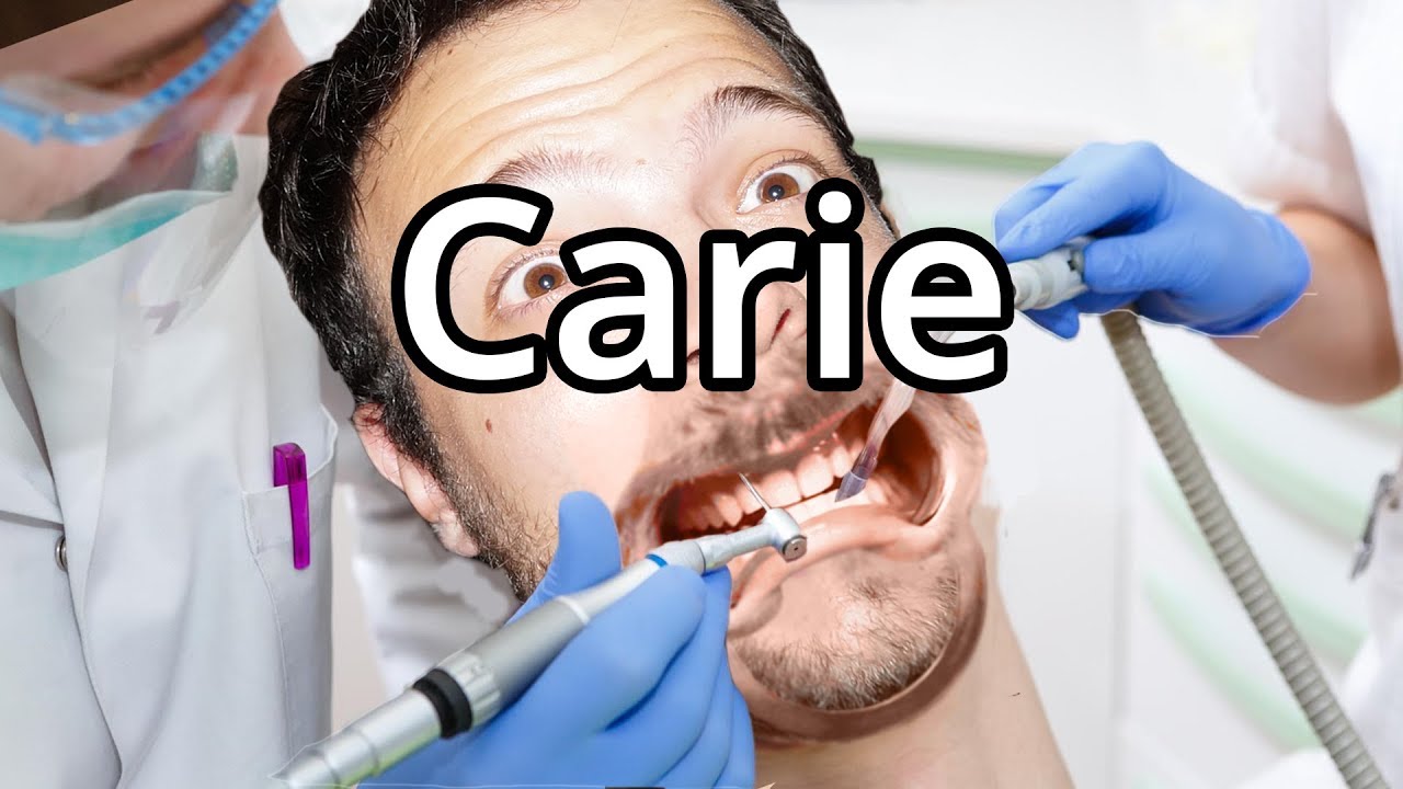 Cosa rende le CARIE così brutte e dolorose? adesso - Spiegazione