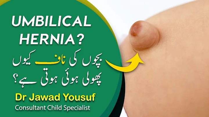 Umbilical hernia in babies| What is umbilical hern...