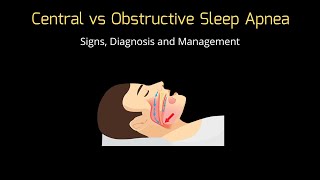 Central Sleep Apnea (CSA) vs Obstructive Sleep Apnea (OSA) | QuickSci |