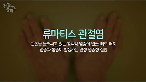 조절 가능한 만성질환 ‘류마티스 관절염’ [건강플러스]