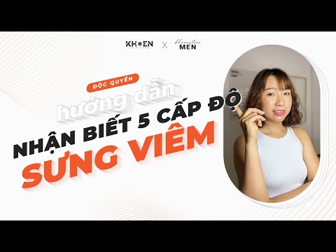 Video: Cách chăm sóc khuyên môi của bạn (có hình ảnh)