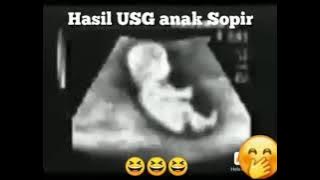hasil usg anak supir🤣