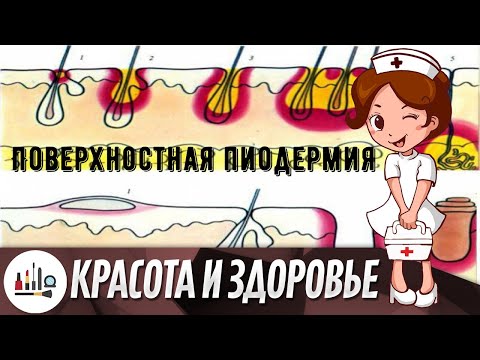 Поверхностная пиодермия