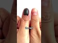 The healing process of a nail #facts #explained #biology #funfacts #healing #humans #humanity