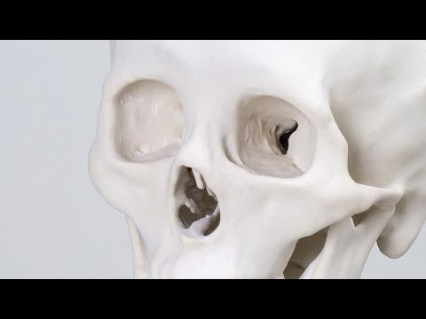 3Dプリンター頭蓋骨モデル （石膏粉末造形 ）