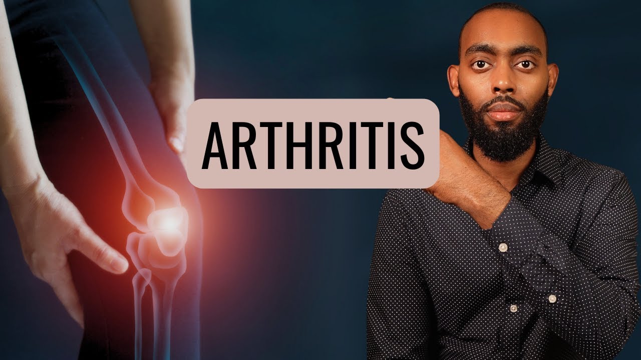 Xanuunka Kala-Goysyada - Arthritis