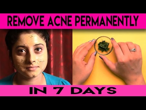 REMOVE ACNE PERMANENTLY IN JUST  DAYS | % NATURAL | REMOVE ACNE SCARS