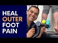 Top 6 Treatments to Heal Outer Foot Pain