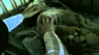 Это видео одно из первых на которых я начинал лечить Это видео одно из первых на которых я начинал лечить