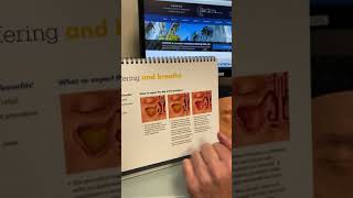 What Is Balloon Sinuplasty?