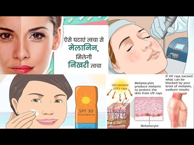 cream to reduce melanin in skin