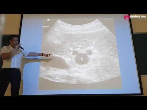 Video 08. Siêu âm đường mật - ThS.BS Nguyễn Quang Thái Dương... - youtube