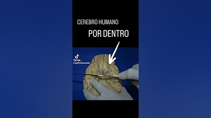 ASÍ ES CORTAR UN 🧠 #brain #cerebro #neuro #shorts