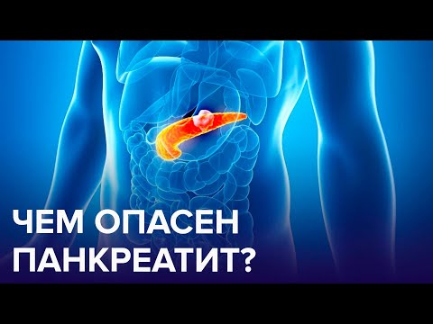 ПАНКРЕАТИТ – болезнь-последствие наших вредных привычек | Доктор 24