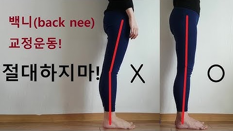 (Eng) 백니[back knee] 교정운동 해봤자 소용 없다! 휜다리, 반장슬, 이게 먼저입니다. Genu recurvatum, valgus, varus, knock knees