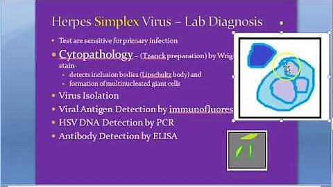 Microbiology 454 c Herpes Virus lab diagnosis Tzan...