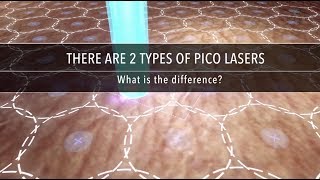 Why Are There Different Types of Pico Laser? | Dr. Kenneth Thean