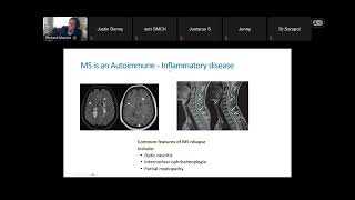 Highlights of EBMT 2026 1